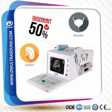 High Class Extended Cardiac OB/GYN 2D B/W Ultrasound System DW-3101A